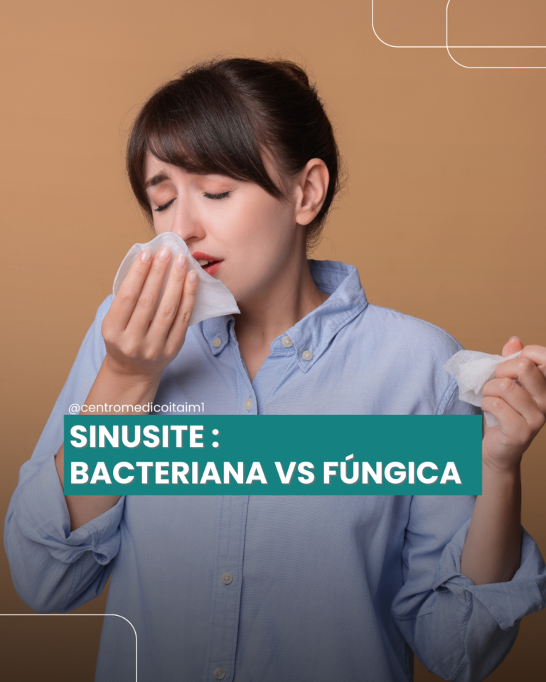 Sinusite bacteriana e sinusite fúngica: entenda as diferenças e quando ...